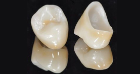 estética dental