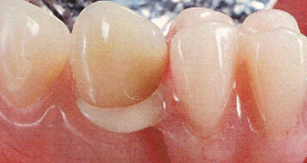 estética dental