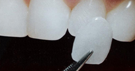 estética dental