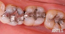 estética dental