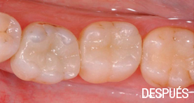 estética dental