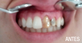 estética dental