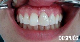 estética dental