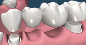 estética dental