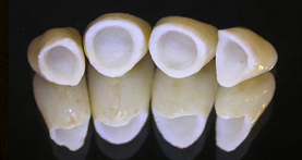 estética dental
