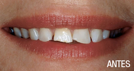 estética dental