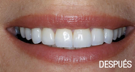 estética dental