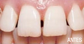 estética dental