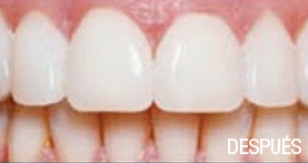 estética dental