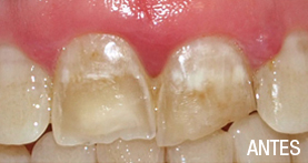 estética dental