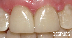 estética dental